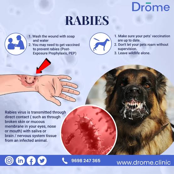 Rabies